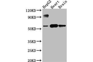 Western Blot Positive WB detected in: HepG2 whole cell lysate, Rat Heart whole cell lysate, Rat Brain whole cell lysate All lanes: CYP17A1 antibody at 1:1000 Secondary Goat polyclonal to rabbit IgG at 1/50000 dilution Predicted band size: 58 kDa Observed band size: 58 kDa (Rekombinanter CYP17A1 Antikörper)