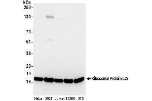 anti-Ribosomal Protein L23 (RPL23) (AA 90-140) antibody