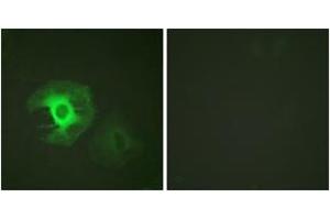 Immunofluorescence analysis of HeLa cells, using Caldesmon (Ab-789) Antibody. (Caldesmon Antikörper  (AA 744-793))