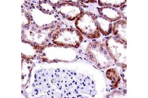 CD70 antibody immunohistochemistry analysis in formalin fixed and paraffin embedded human kidney tissue. (CD70 Antikörper  (AA 72-101))