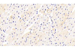 Immunohistochemistry (IHC) image for anti-Fibronectin Type III Domain Containing 5 (FNDC5) (AA 2-137) antibody (ABIN7430180)