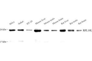 Western blot analysis of RPL10L (ABIN7075429) at dilution of 1: 1000 (RPL10L Antikörper)