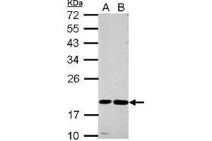 WB Image Sample (30 ug of whole cell lysate) A: A549 B: MCF-7 12% SDS PAGE antibody diluted at 1:1000 (CST7 Antikörper)