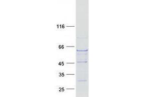 Western Blotting (WB) image for Tubulin, beta 6 (TUBb6) protein (Myc-DYKDDDDK Tag) (ABIN2734584)