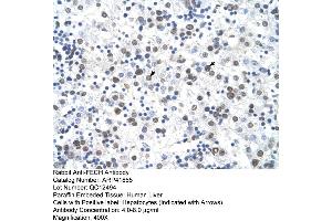 Rabbit Anti-FECH Antibody  Paraffin Embedded Tissue: Human Liver Cellular Data: Hepatocytes Antibody Concentration: 4. (FECH Antikörper  (N-Term))