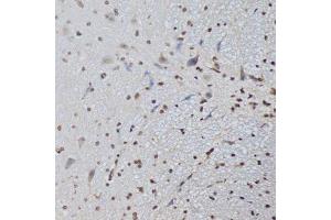 Chromatin Immunoprecipitation (ChIP) image for anti-CCCTC-Binding Factor (Zinc Finger Protein) (CTCF) (AA 1-260) antibody (ABIN3021507)