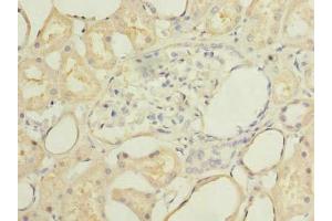 Immunohistochemistry of paraffin-embedded human kidney tissue using ABIN7168673 at dilution of 1:100
