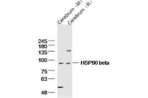 Lane 1: mouse cerebrum lysates Lane 2: rat cerebrum lysates probed with HSP90 beta Polyclonal Antibody, Unconjugated  at 1:300 dilution and 4˚C overnight incubation.