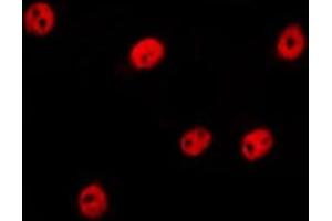 ABIN6275260 staining Hela by IF/ICC. (MLF1 Antikörper  (Internal Region))
