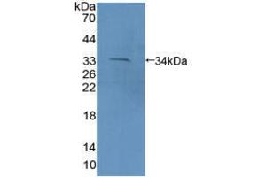 Western blot analysis of recombinant Mouse PCDH15. (PCDH15 Antikörper  (AA 45-270))