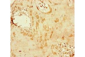 Immunohistochemistry of paraffin-embedded human placenta tissue using ABIN7150406 at dilution of 1:100 (CCDC111 Antikörper  (AA 305-537))