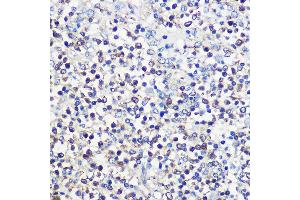 Immunohistochemistry of paraffin-embedded human spleen using CD80 Rabbit pAb (ABIN7266220) at dilution of 1:100 (40x lens). (CD80 Antikörper  (AA 1-100))