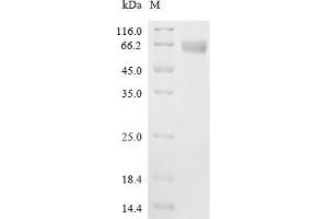 (Tris-Glycine gel) Discontinuous SDS-PAGE (reduced) with 5 % enrichment gel and 15 % separation gel.