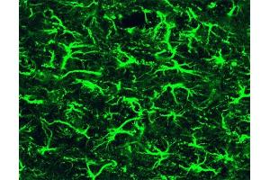 Immunofluorescence staining of a mouse brain section. (GFAP Antikörper)