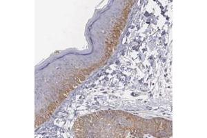 Immunohistochemical staining of human skin with NREP polyclonal antibody  shows moderate cytoplasmic positivity in epidermal and adnexal cells. (NREP Antikörper)