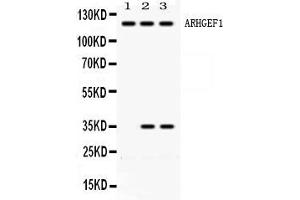 Western blot analysis of ARHGEF1 expression in rat brain extract ( Lane 1), HELA whole cell lysates ( Lane 2) and JURKAT whole cell lysates ( Lane 3). (ARHGEF1 Antikörper  (N-Term))