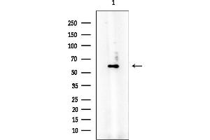Western blot analysis of lysates from Mouse kidney, using PKM2 Mouse Monoclonal Antibody at 1/1000 dilution.