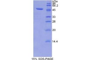 SDS-PAGE analysis of Mouse Lipocalin 12 Protein.