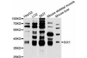 Western blot analysis of extracts of various cell lines, using SIX1 antibody (ABIN5998814) at 1:3000 dilution. (SIX Homeobox 1 Antikörper)