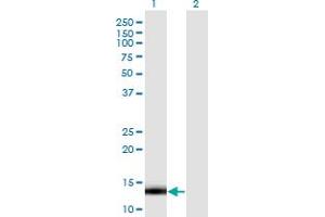 Western Blot analysis of LDOC1 expression in transfected 293T cell line by LDOC1 monoclonal antibody (M13), clone 3E5.