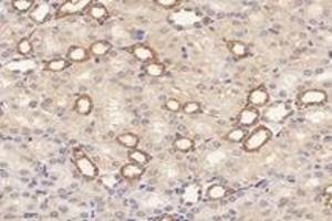 Immunohistochemistry (Paraffin-embedded Sections) (IHC (p)) image for anti-Ribosomal Protein L10 (RPL10) antibody (ABIN7075428)