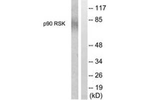 Western blot analysis of extracts from 293 cells, treated with PMA 125ng/ml 30', using p90 RSK (Ab-380) Antibody. (RPS6KA3 Antikörper  (AA 346-395))