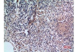 Immunohistochemistry (IHC) analysis of paraffin-embedded Human Lung, antibody was diluted at 1:100. (CD38 Antikörper  (Internal Region))