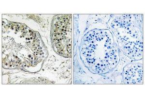 Immunohistochemistry (IHC) image for anti-Carbohydrate (Chondroitin 4) Sulfotransferase 13 (CHST13) (Internal Region) antibody (ABIN1850992) (CHST13 Antikörper  (Internal Region))