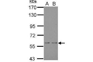 WB Image Sample (30 ug of whole cell lysate) A: JC B: BCL-1 7. (NOX1 Antikörper)