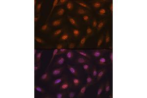 Immunofluorescence analysis of U-2 OS cells using K48-linkage Specific Ubiquitin Rabbit mAb (ABIN1680189, ABIN3017871, ABIN3017872 and ABIN7101530) at dilution of 1:100 (40x lens).