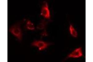ABIN6275863 staining HepG2 cells by IF/ICC. (ACTBL2 Antikörper  (Internal Region))