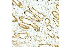 Immunohistochemistry of paraffin-embedded human kidney using IDH1 Rabbit mAb (ABIN7268027) at dilution of 1:500 (40x lens). (IDH1 Antikörper)