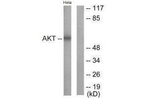 Western blot analysis of extracts from NIH/3T3 cells, treated with Insulin (0. (AKT1 Antikörper  (Tyr326))