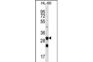 CA6 Antibody (C-term) (ABIN656592 and ABIN2845853) western blot analysis in HL-60 cell line lysates (35 μg/lane). (CA6 Antikörper  (C-Term))