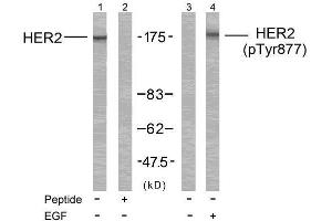 Western blot analysis of extract from MDA-MB-231 cells treated or untreated with EGF using HER2 (Ab-877) Antibody (E021070, Line 1 and 2) and HER2 (phospho-Tyr877) antibody (E011075, Line 3 and 4). (ErbB2/Her2 Antikörper  (pTyr877))