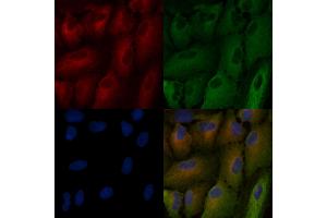 ABIN7094434 and ABIN7098482 staining  cells by IF/ICC. (FURIN Antikörper  (N-Term))