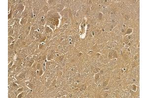 SNPH Mouse Monoclonal Antibody at 1/100 staining rat brain tissue by IHC-P. (Syntaphilin Antikörper)