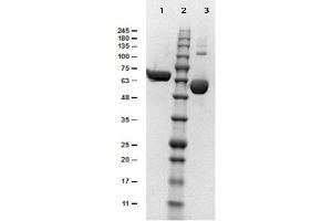 SDS-PAGE results of Human Albumin. (Albumin Protein (ALB))