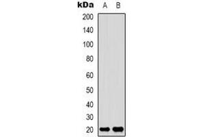 Western blot analysis of Adenylate Kinase 6 expression in Jurkat (A), HepG2 (B) whole cell lysates.