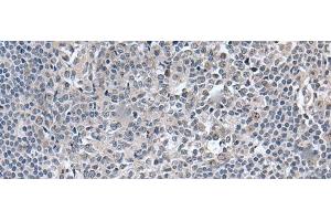 Immunohistochemistry of paraffin-embedded Human tonsil tissue using EDARADD Polyclonal Antibody at dilution of 1:50(x200)