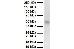 Western Blotting (WB) image for anti-Protein Inhibitor of Activated STAT, 2 (PIAS2) (C-Term) antibody (ABIN2779873)