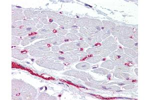 Anti-BMP10 antibody IHC of human heart.