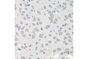 Immunohistochemistry of paraffin-embedded mouse brain using C1GALT1C1 antibody at dilution of 1:100 (x40 lens).