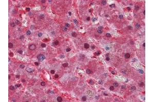 Immunohistochemical analysis of paraffin-embedded human Liver tissues using LPA antibody (Apo(a) Antikörper)