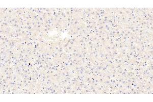 Detection of TRPA1 in Human Liver Tissue using Polyclonal Antibody to Transient Receptor Potential Cation Channel Subfamily A, Member 1 (TRPA1) (TRPA1 Antikörper  (AA 63-370))