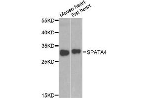Western blot analysis of extracts of mouse heart and rat heart cell lines, using SPATA4 antibody. (SPATA4 Antikörper)