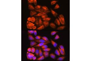 Immunofluorescence analysis of HeLa cells using ODF2 Rabbit pAb (ABIN7269128) at dilution of 1:100. (ODF2 Antikörper  (AA 630-829))