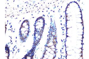 Immunohistochemistry of paraffin-embedded human colon using MB/MB/ML2 Rabbit mAb (ABIN1679325, ABIN3019109, ABIN3019110 and ABIN7101716) at dilution of 1:100 (40x lens).