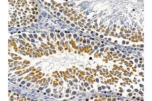 ABIN6264586 and ABIN6279745 at 1/100 staining rat testis tissue by IHC-P.