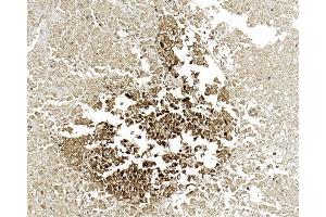Immunohistochemical analysis of paraffin-embedded Human pancreas section using Pink1 (ABIN6244274 and ABIN6577058). (ENO2/NSE Antikörper)